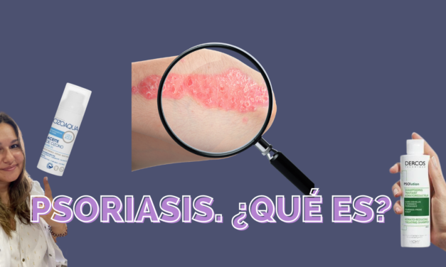 ¿Qué es la Psoriasis? Tipos y Tratamiento