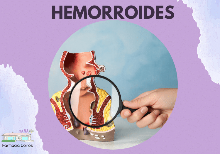 HEMORROIDES