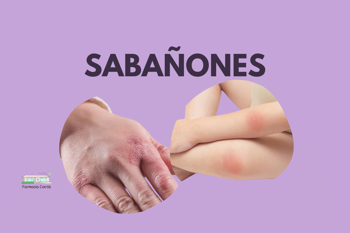 TTO SABANONES - El Blog Tañá